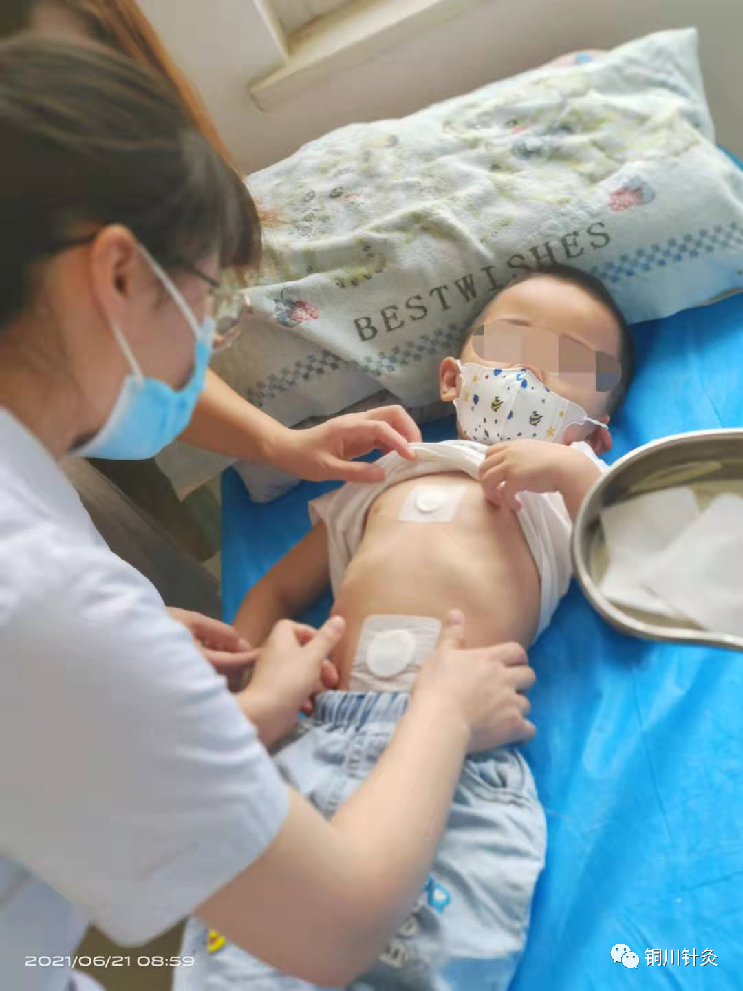 针灸调理亚健康不理想_针灸调节亚健康的原理_针灸调节亚健康