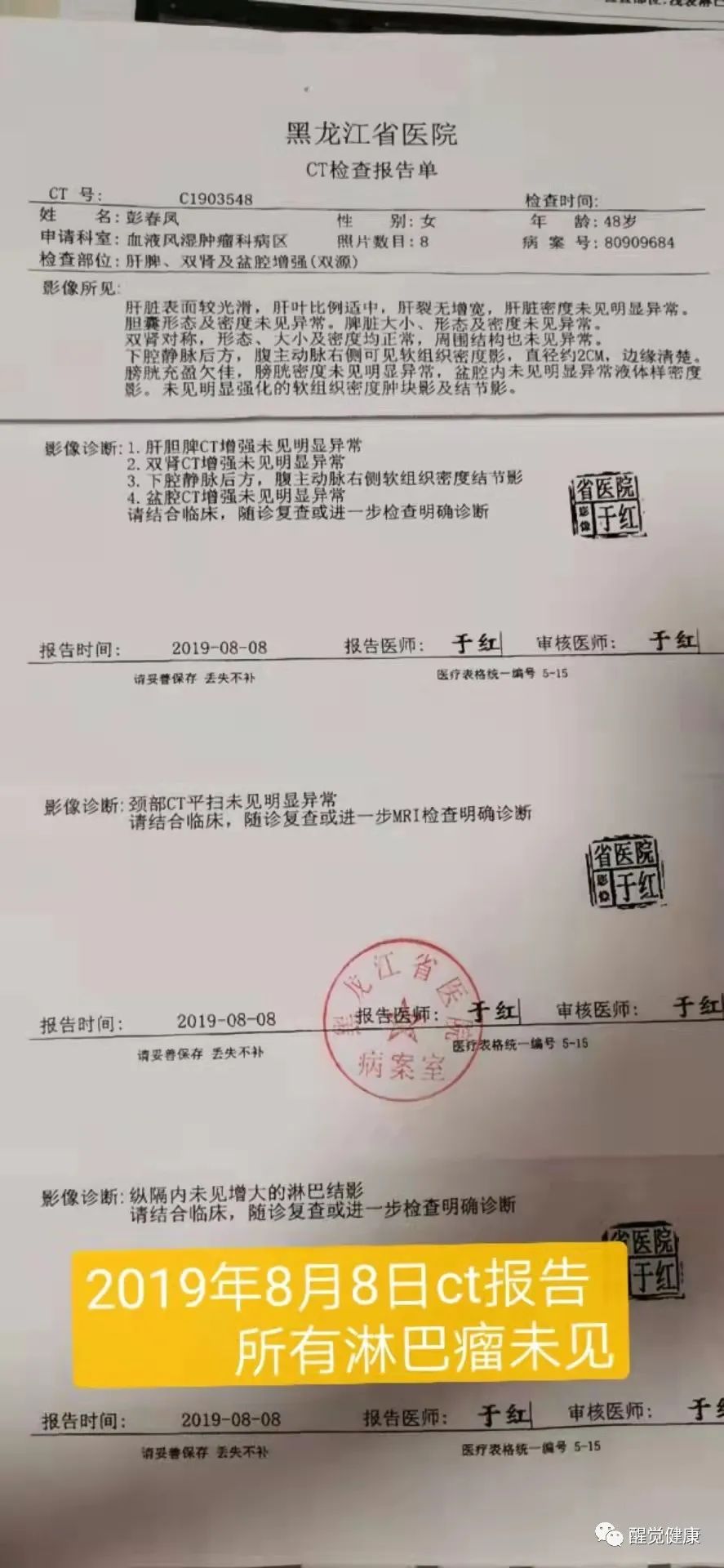 癌症的结节是什么意思_癌症和生活方式结缘有关吗_什么是癌症结疗