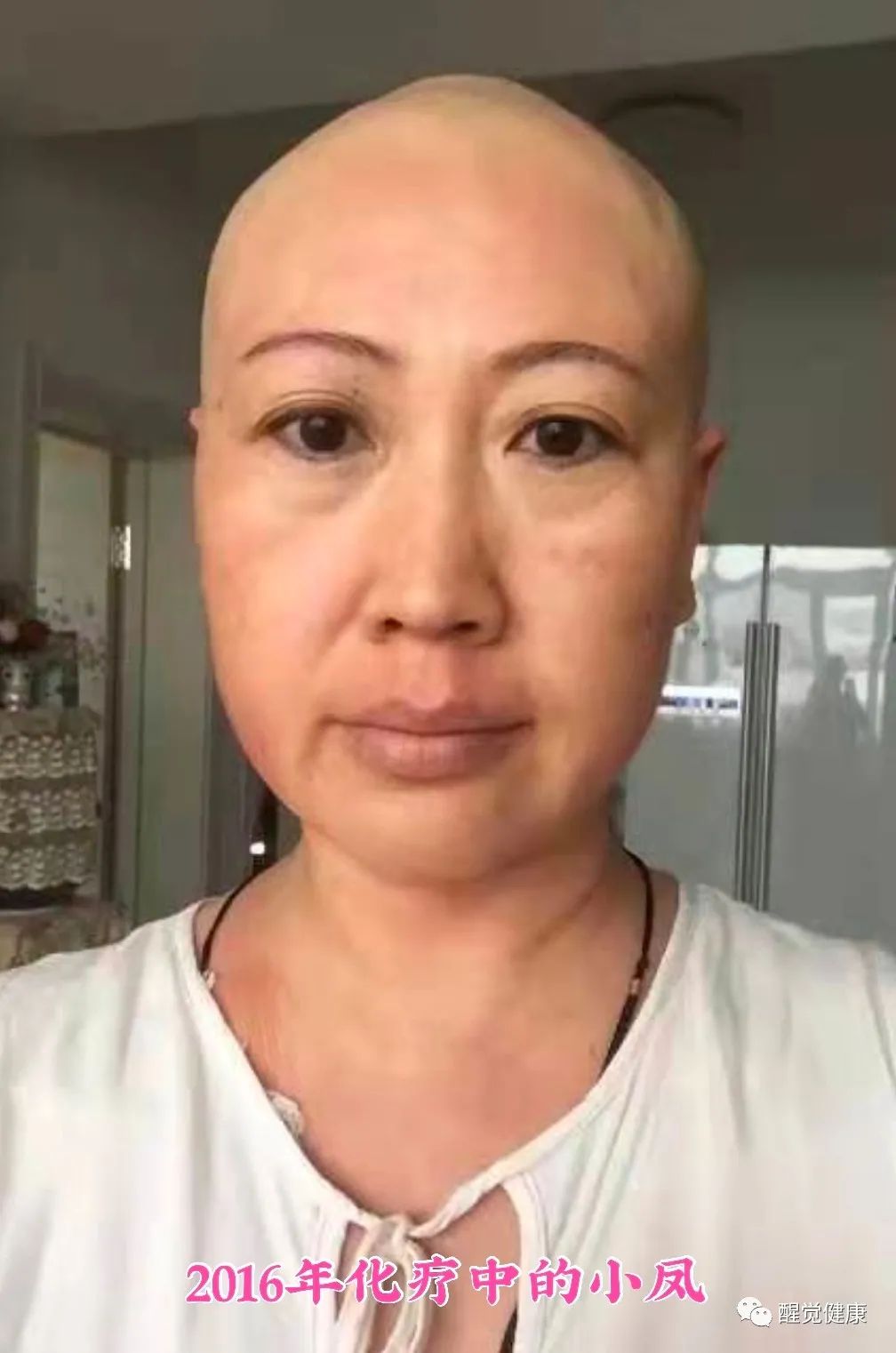 什么是癌症结疗_癌症和生活方式结缘有关吗_癌症的结节是什么意思