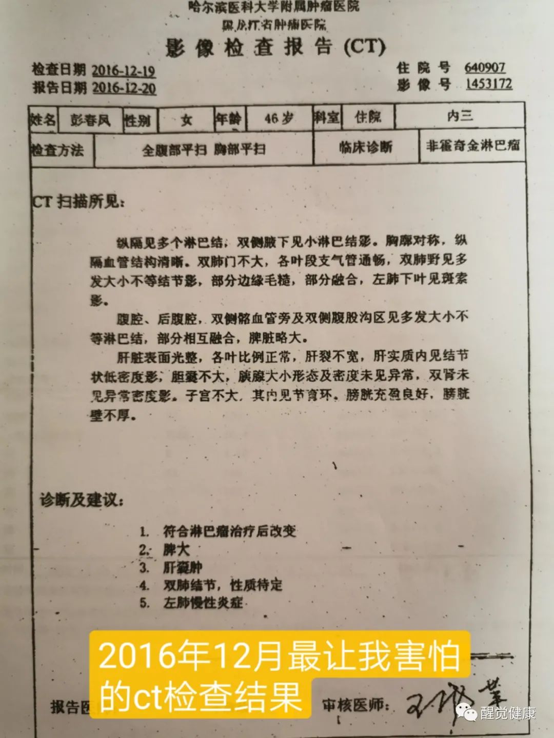 什么是癌症结疗_癌症和生活方式结缘有关吗_癌症的结节是什么意思