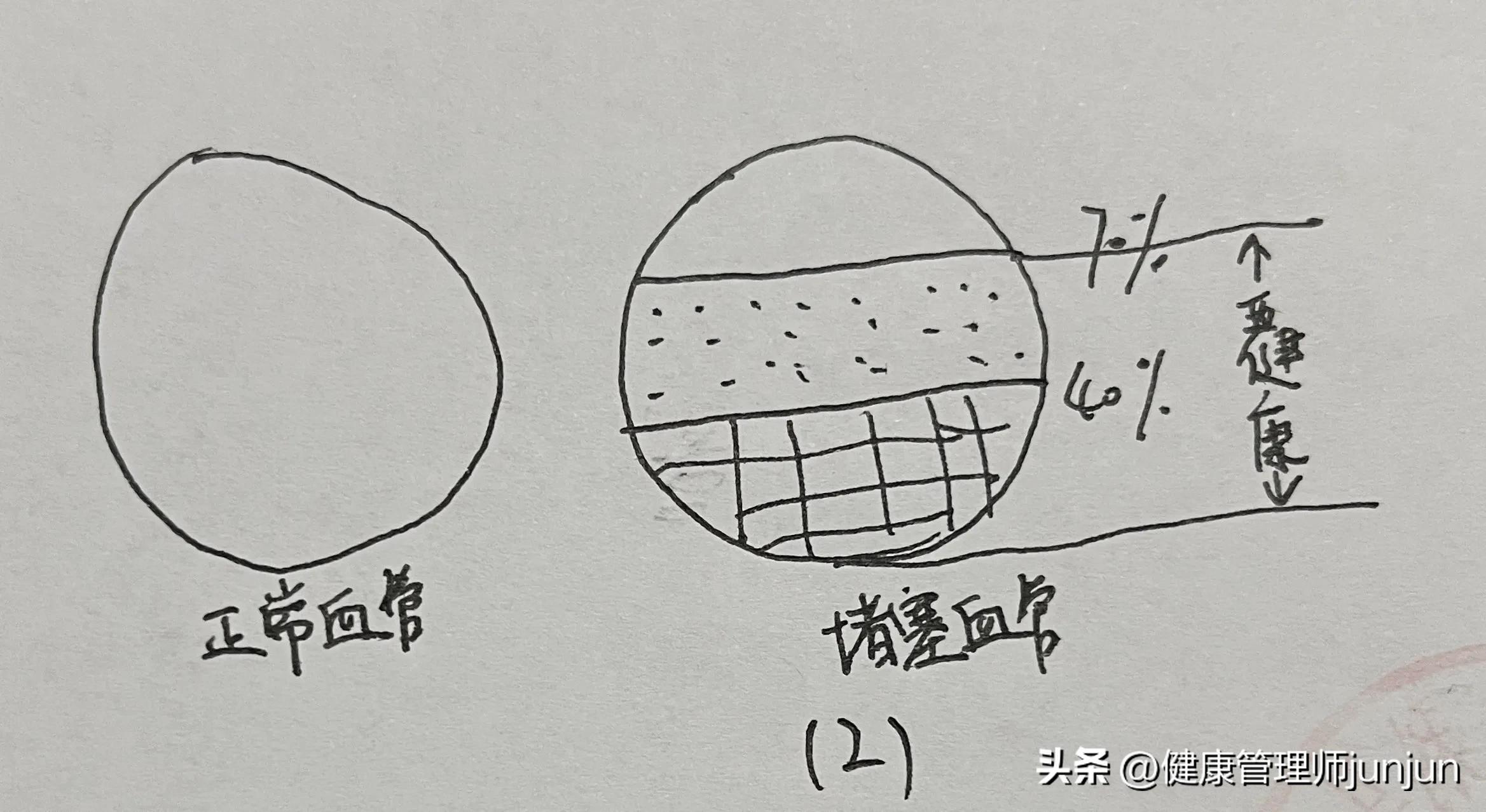 亚健康健康与疾病之间_亚健康健康与疾病之间_亚健康健康与疾病之间