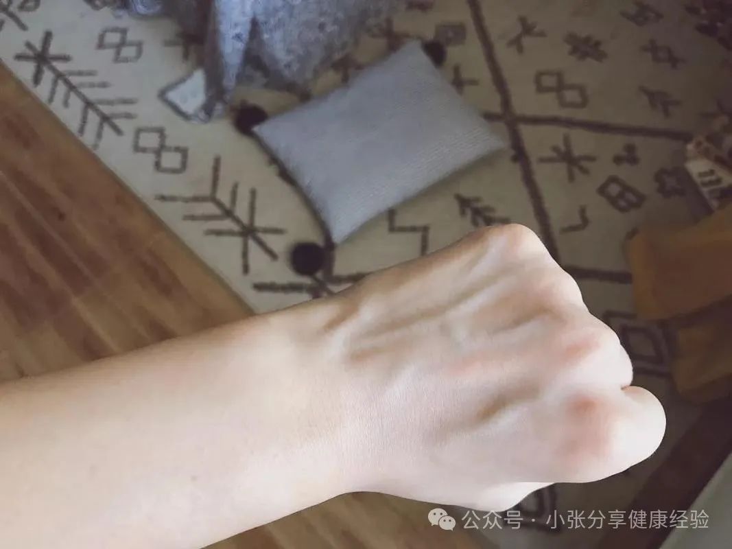皮肤黑的人身体健康吗_皮肤黑身体好_皮肤黑的人体质好吗