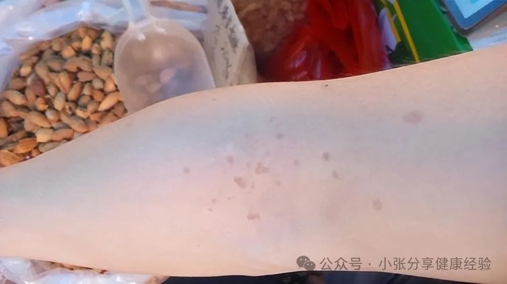 皮肤黑的人身体健康吗_皮肤黑身体好_皮肤黑的人体质好吗